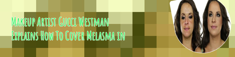 Best foundation to cover melasma